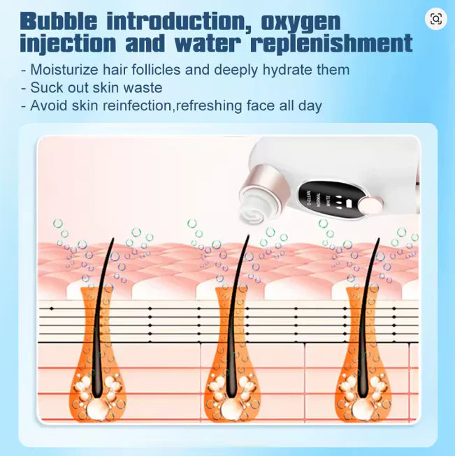 Super Micro Bubble Facial Cleansing Device & Blackhead Remover