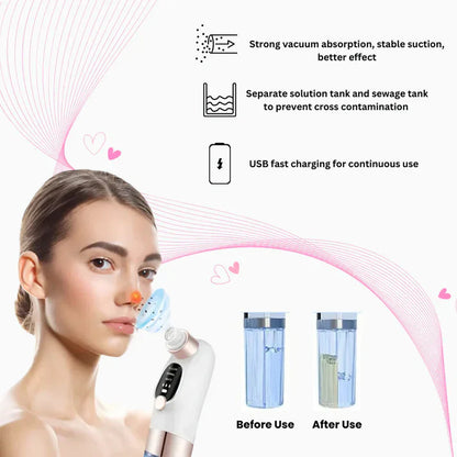 Super Micro Bubble Facial Cleansing Device & Blackhead Remover